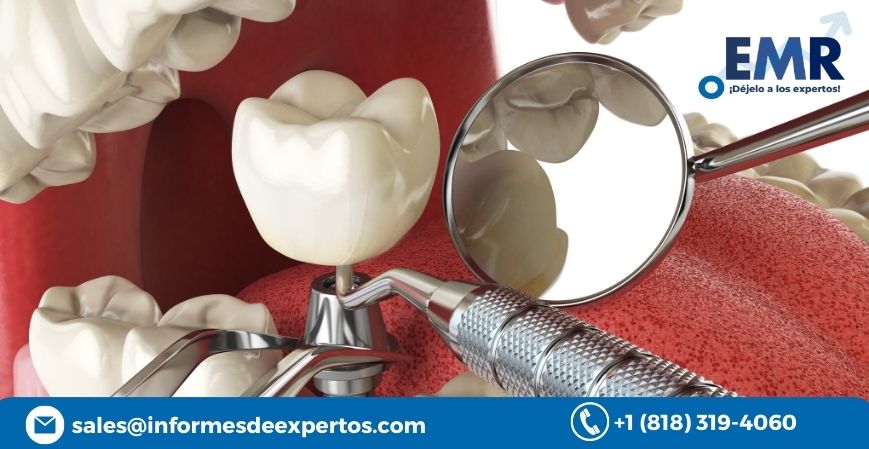 Dental implants Market, Report, Share, Size 2023-2028