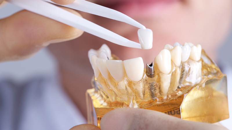 “Looking for a Dentist in Sunny Beach Near Me? Your Guide to Quality Dental Care